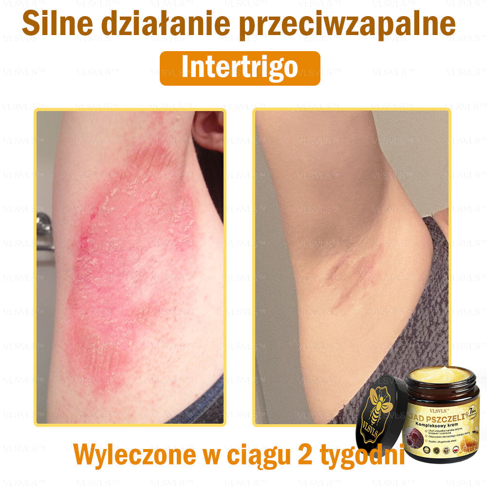 VLSVLS™ Krem Komprehensywny z Jadami Pszczół 🧑⚕️ Rekomendowany przez Dermatologów 50g
