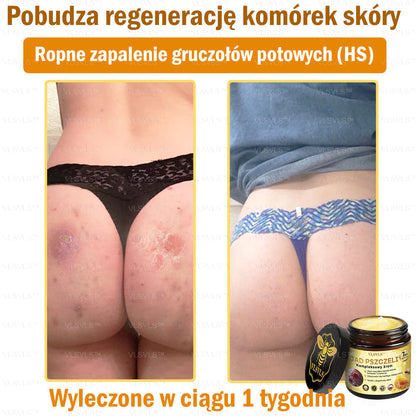VLSVLS™ Krem Komprehensywny z Jadami Pszczół 🧑‍⚕️ Rekomendowany przez Dermatologów 50g