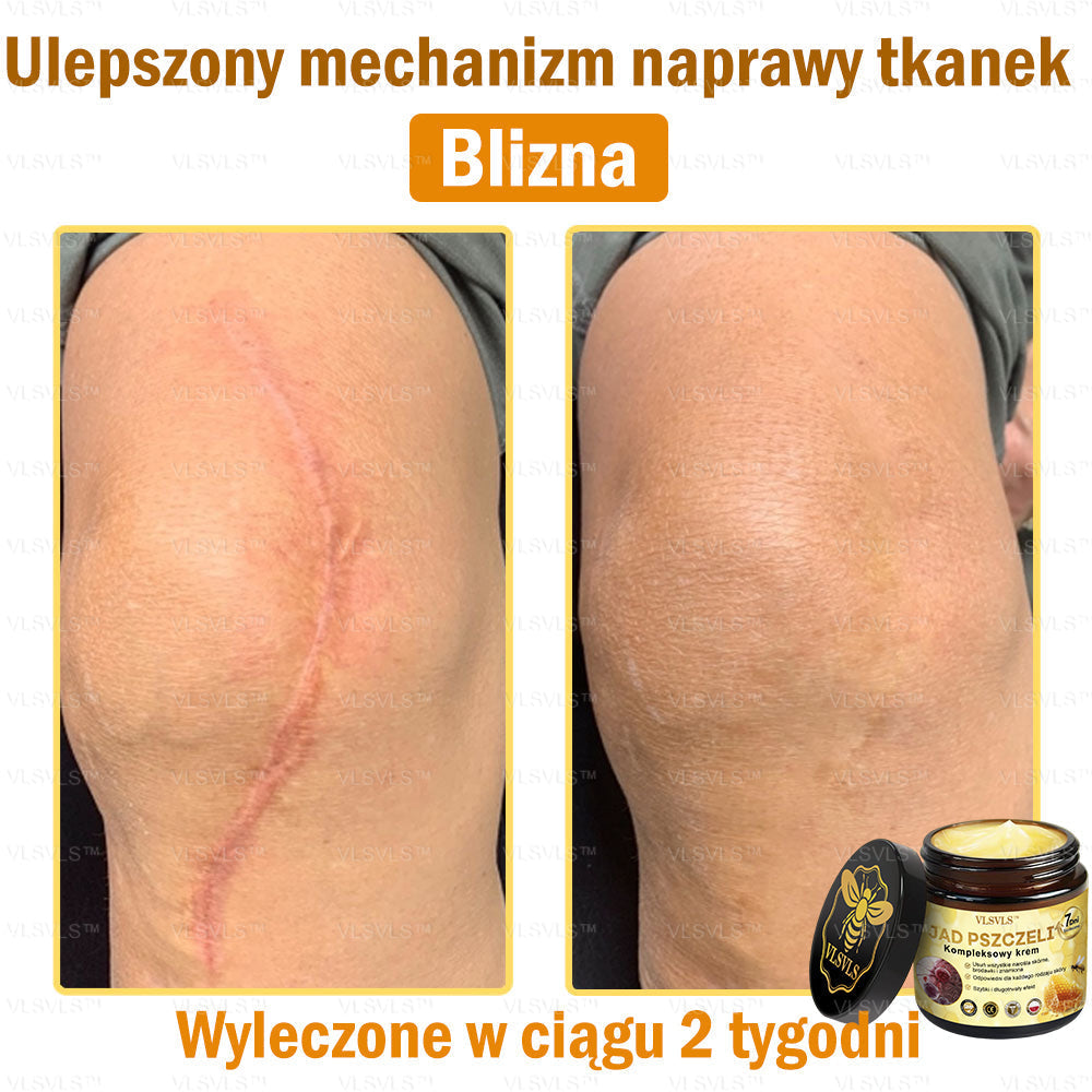 VLSVLS™ Krem Komprehensywny z Jadami Pszczół 🧑‍⚕️ Rekomendowany przez Dermatologów 50g