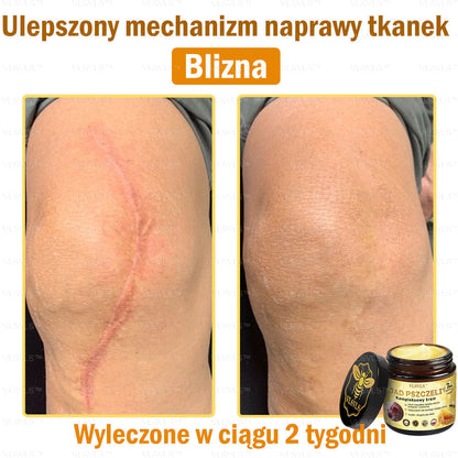 VLSVLS™ Krem Komprehensywny z Jadami Pszczół 🧑‍⚕️ Rekomendowany przez Dermatologów 50g