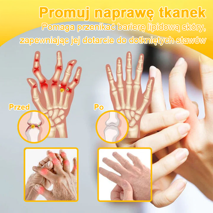 🦴TLOPA® Toksyna botulinowa i jad pszczeli Krem przeciwbólowy do gojenia kości🔥🔥🔥🔥