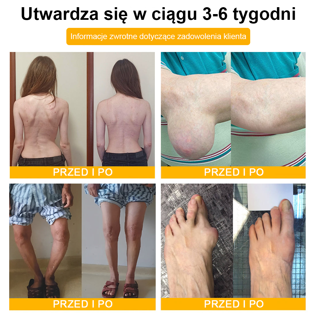 🦴TLOPA® Toksyna botulinowa i jad pszczeli Krem przeciwbólowy do gojenia kości🔥🔥🔥🔥