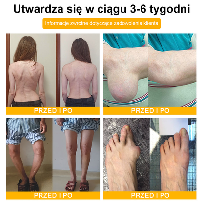 🦴TLOPA® Toksyna botulinowa i jad pszczeli Krem przeciwbólowy do gojenia kości🔥🔥🔥🔥