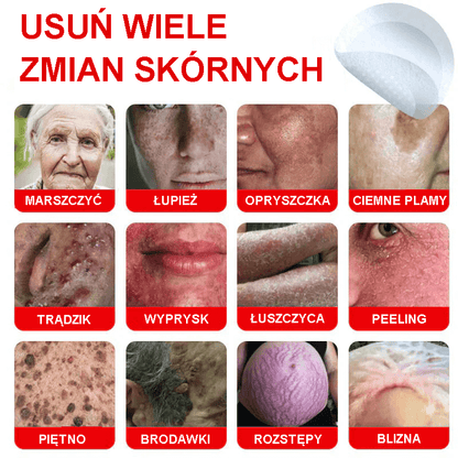 Płatek mikroigłowy TLOPA® do usuwania narośli skórnych, wyprodukowany w Polsce