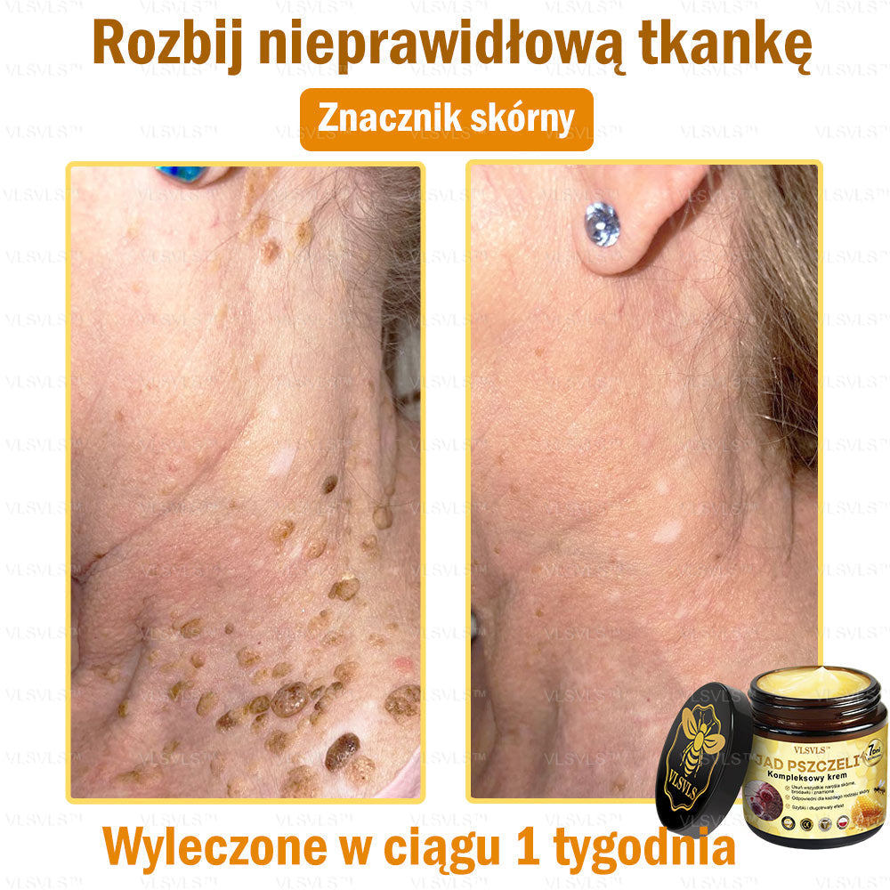 VLSVLS™ Krem Komprehensywny z Jadami Pszczół 🧑‍⚕️ Rekomendowany przez Dermatologów 50g