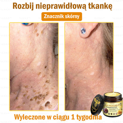 VLSVLS™ Krem Komprehensywny z Jadami Pszczół 🧑‍⚕️ Rekomendowany przez Dermatologów 50g