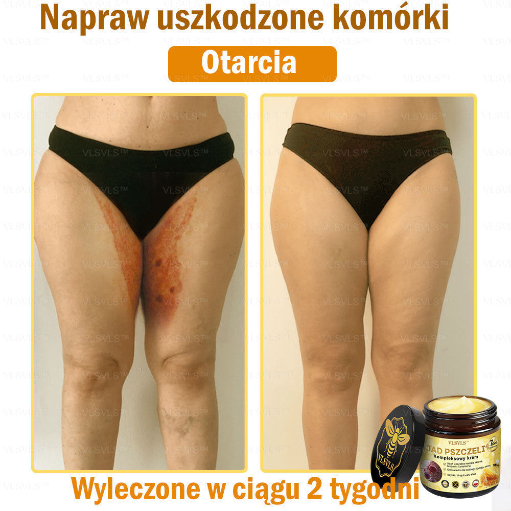 VLSVLS™ Krem Komprehensywny z Jadami Pszczół 🧑‍⚕️ Rekomendowany przez Dermatologów 50g