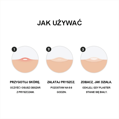 💎Oryginalne plastry – hydrokoloidowe plastry na trądzik nr 1, które zmniejszają wypryski i zaskórniki już po jednym użyciu; Nocne plastry na trądzik do twarzy i skóry (36 sztuk)