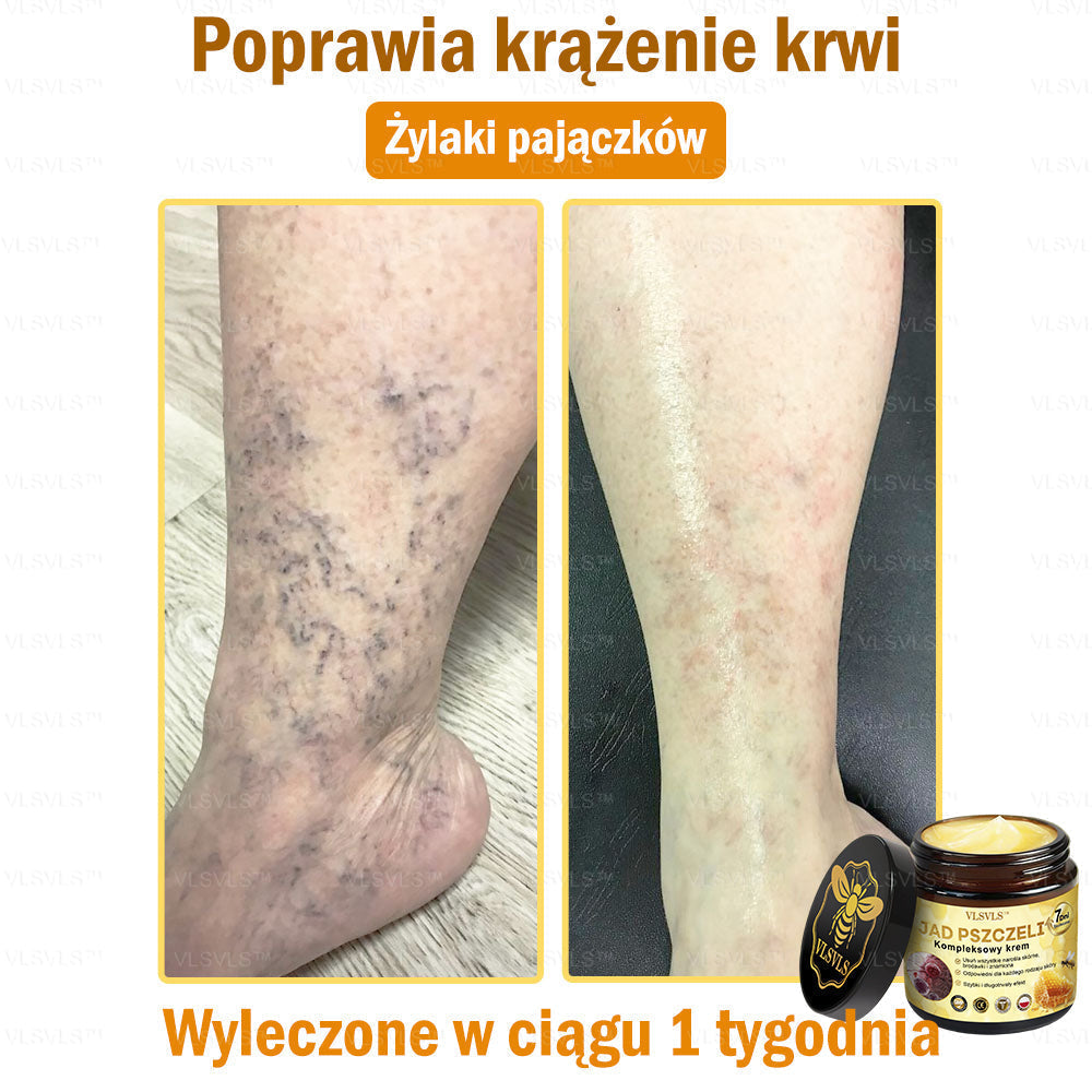 VLSVLS™ Krem Komprehensywny z Jadami Pszczół 🧑‍⚕️ Rekomendowany przez Dermatologów 50g