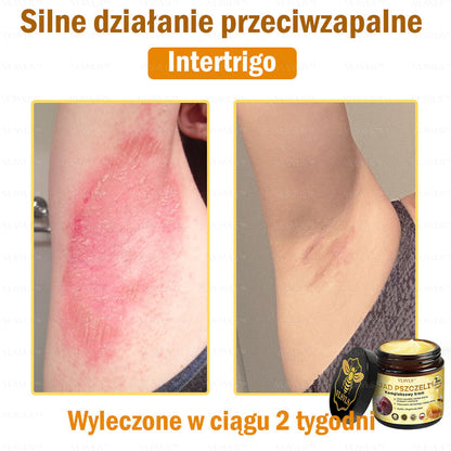 VLSVLS™ Krem Komprehensywny z Jadami Pszczół 🧑‍⚕️ Rekomendowany przez Dermatologów 50g