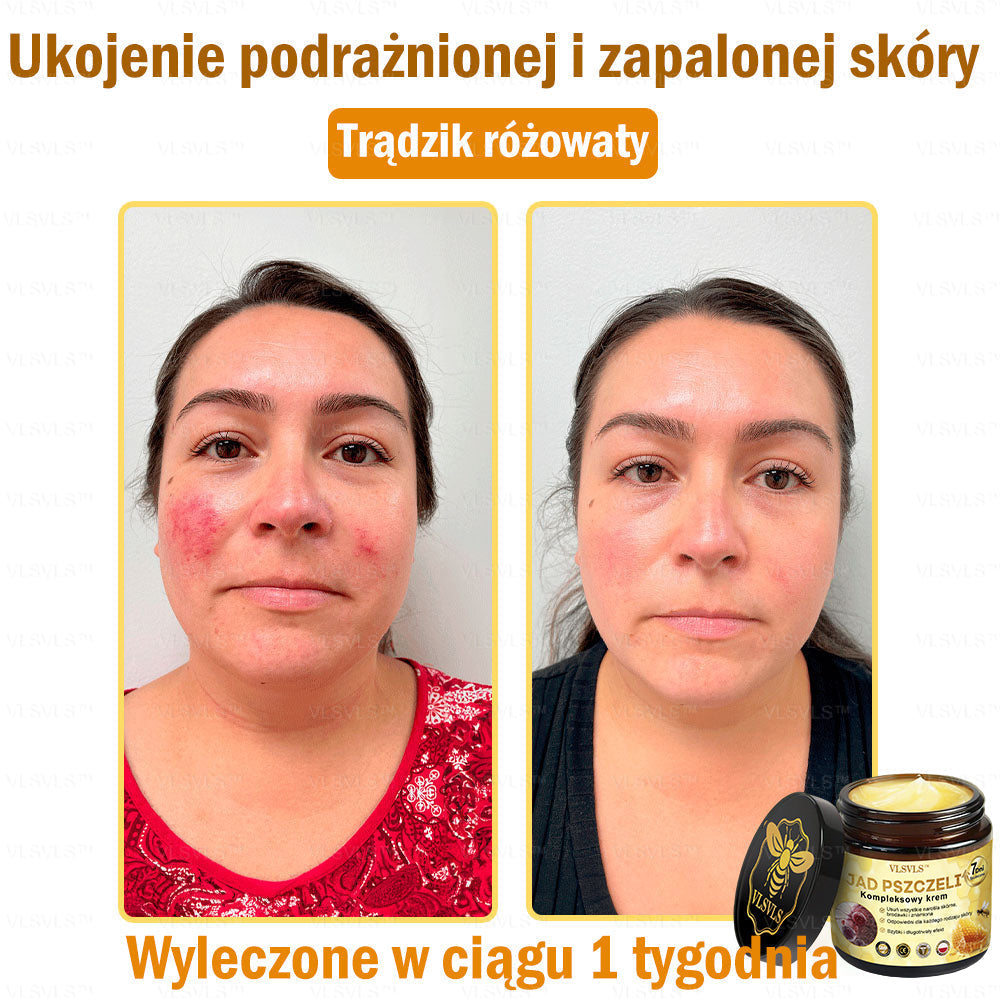 VLSVLS™ Krem Komprehensywny z Jadami Pszczół 🧑‍⚕️ Rekomendowany przez Dermatologów 50g