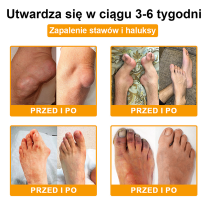🦴TLOPA® Toksyna botulinowa i jad pszczeli Krem przeciwbólowy do gojenia kości🔥🔥🔥🔥