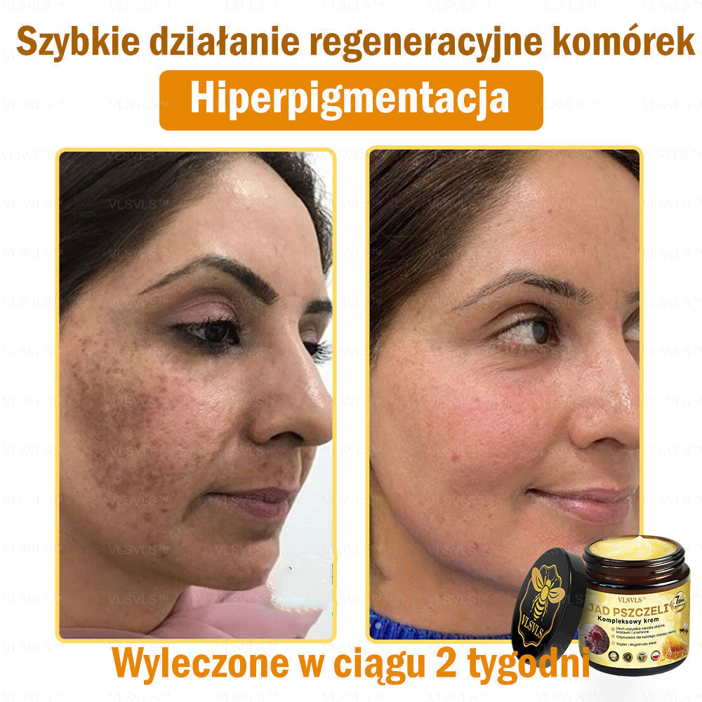 VLSVLS™ Krem Komprehensywny z Jadami Pszczół 🧑‍⚕️ Rekomendowany przez Dermatologów 50g